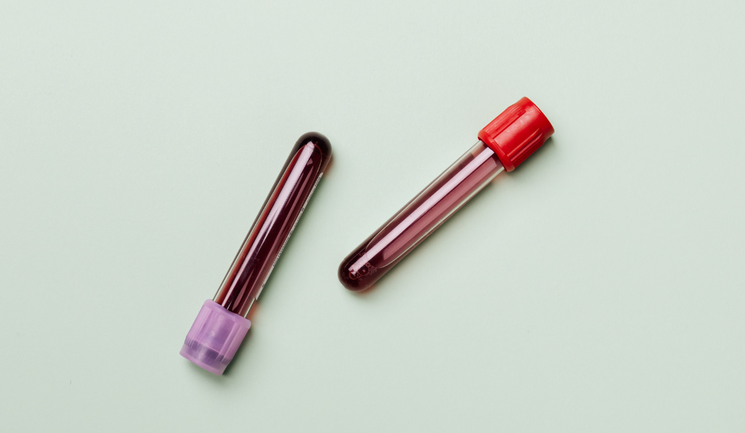 Is Chronic Inflammation Detectable in Your Blood Work? Here’s What to Look For