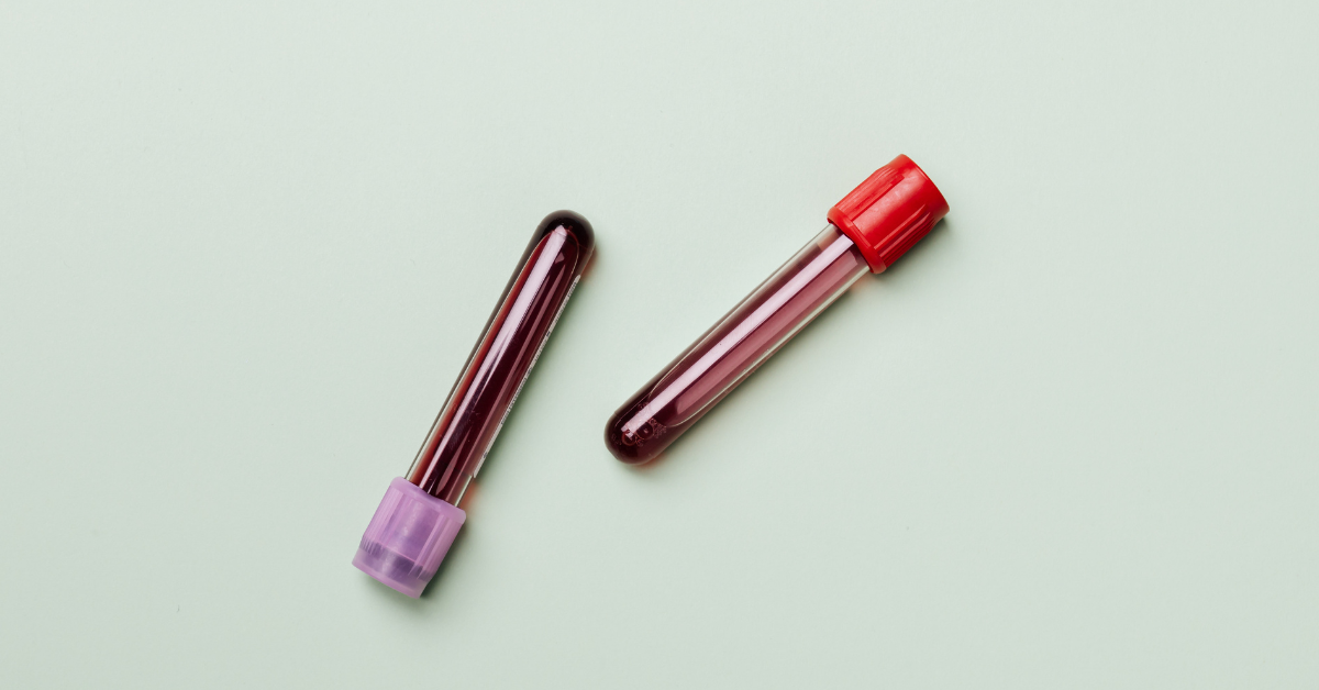 Is Chronic Inflammation Detectable in Your Blood Work? Here’s What to Look For